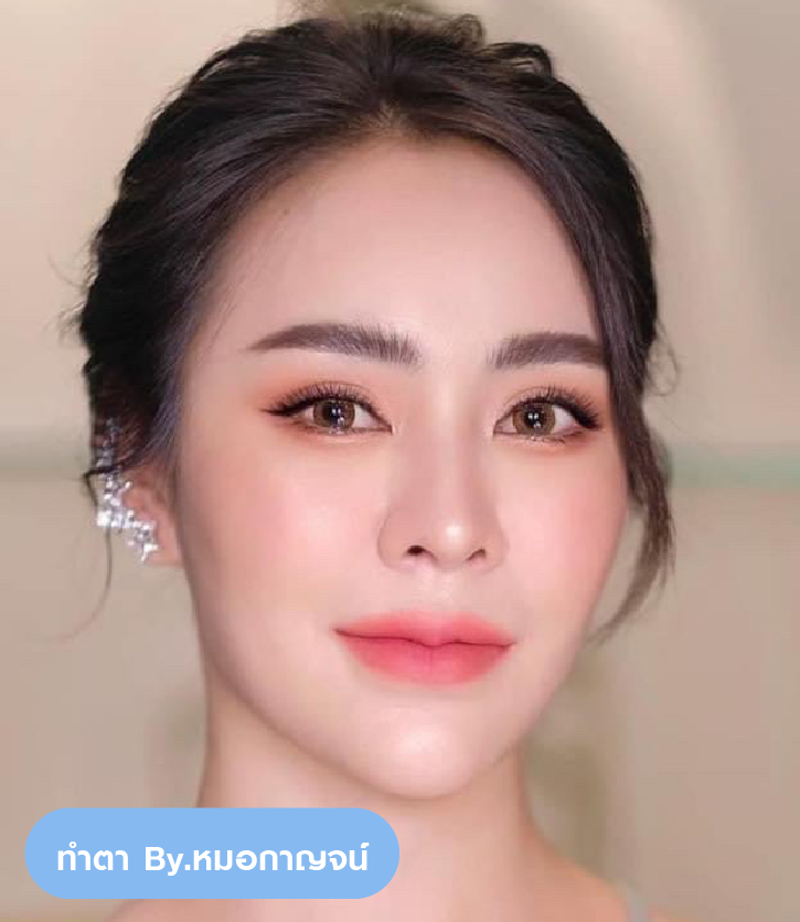 Doctor Garn Clinic คลินิกหมอกาญจน์ ศัลยกรรมตาสองชั้น ทำตา 2 ชั้น รีวิวกว่า 5000 เคส