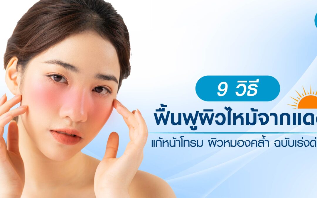 9 วิธีฟื้นฟูผิวไหม้จากแดด แก้หน้าโทรม ผิวหมองคล้ำ ฉบับเร่งด่วน